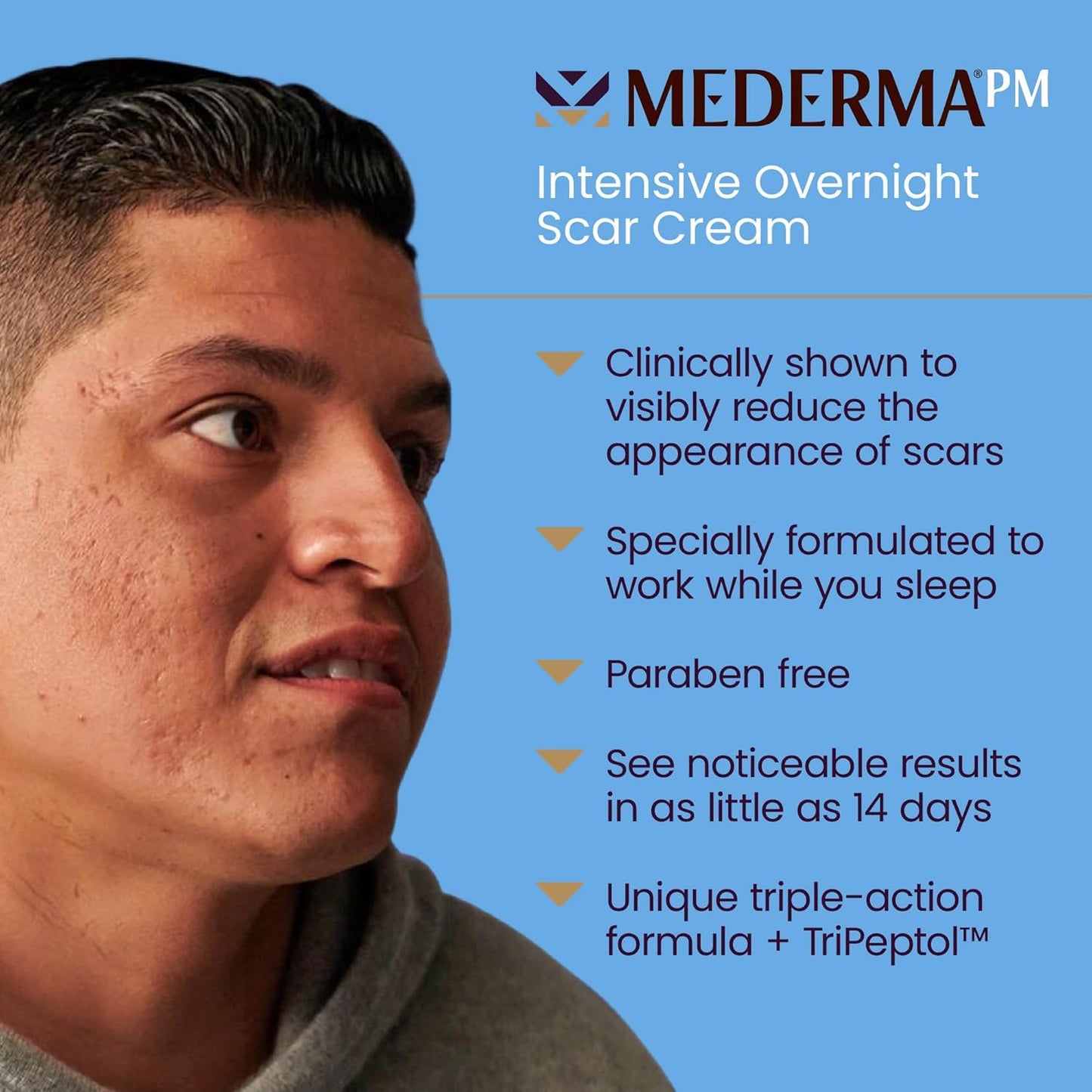 Mederma PM Intensive Overnight Scar Cream, Works with Skin's Nighttime Regenerative Activity, Clinically Shown to Make Scars Smaller and Less Visible, 1.0 Oz (28g)